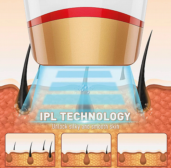 ����� ���� ����� ���� IPL ���: MC-1280 